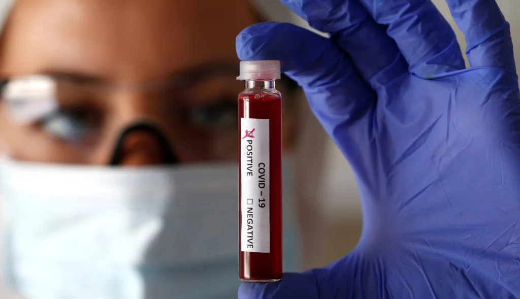 На Сумщині у п'ятьох людей лабораторно підтвердили коронавірус