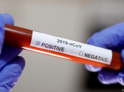 На Полтавщині вже 26 хворих на коронавірус