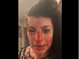 В Днепре жестоко избили известную активистку