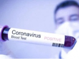 На Сумщині збільшилась кількість випадків коронавірусу