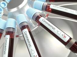 Днепропетровщина отказывается от экспресс-тестов на коронавирус