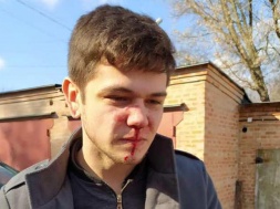 У Полтаві побили оператора: постраждалий стверджує, що це через його фільми про Майдан