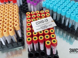 4 з 5 випадків коронавірусу на Полтавщині зафіксували в Кременчуці