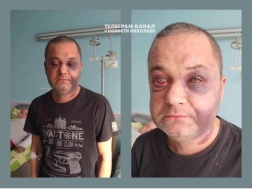 В Николаеве военкоматчики жестоко избили пожилого человека