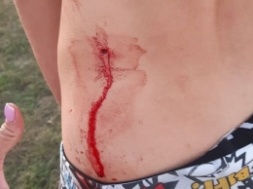 Бывший депутат ударил подростка отверткой за езду на мотоцикле у школьного стадиона