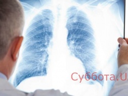 Массовая пневмония в Запорожской области: терапию переквалифицировали в пульмонологию