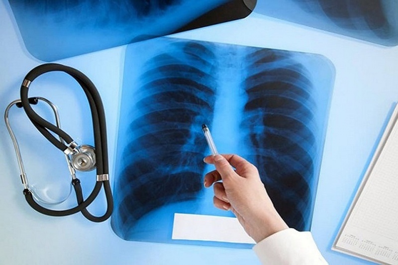 В Запорожской области обнаружили туберкулез открытой формы: больных срочно госпитализировали