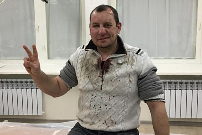 В Энергодаре проломили череп бывшему депутату и действующему адвокату