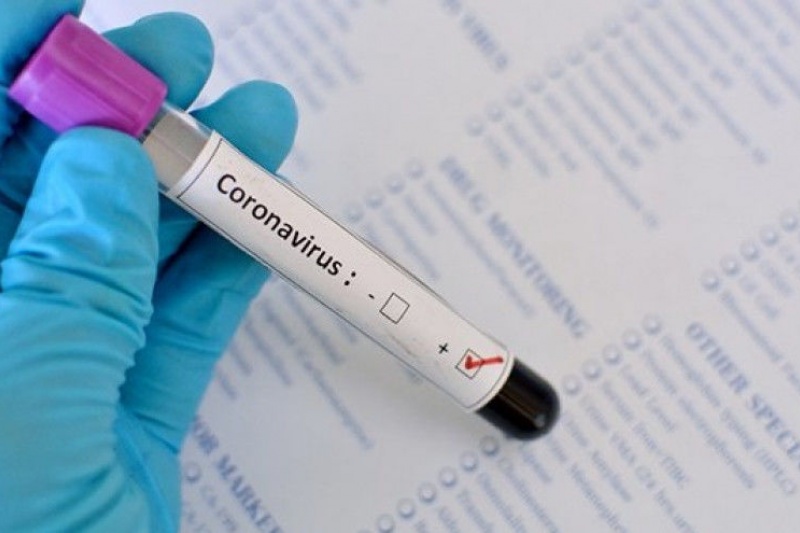В Днепропетровской области подтвердили два случая заражения коронавирусом