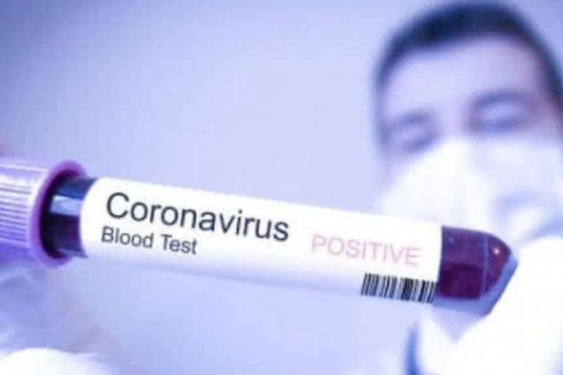 На Сумщині збільшилась кількість випадків коронавірусу