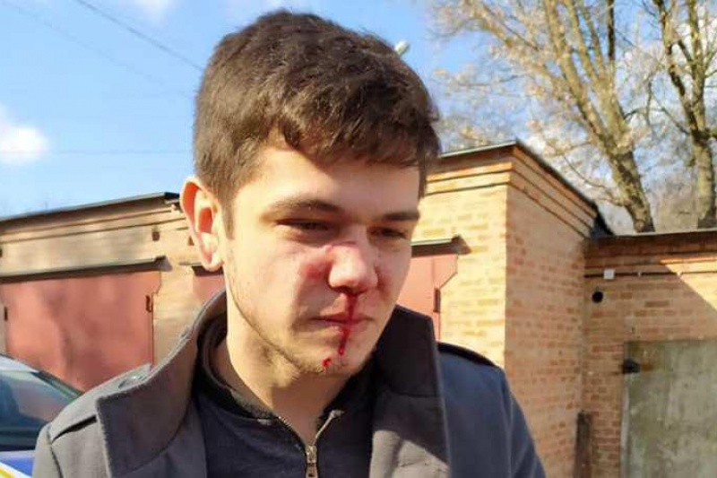 У Полтаві побили оператора: постраждалий стверджує, що це через його фільми про Майдан