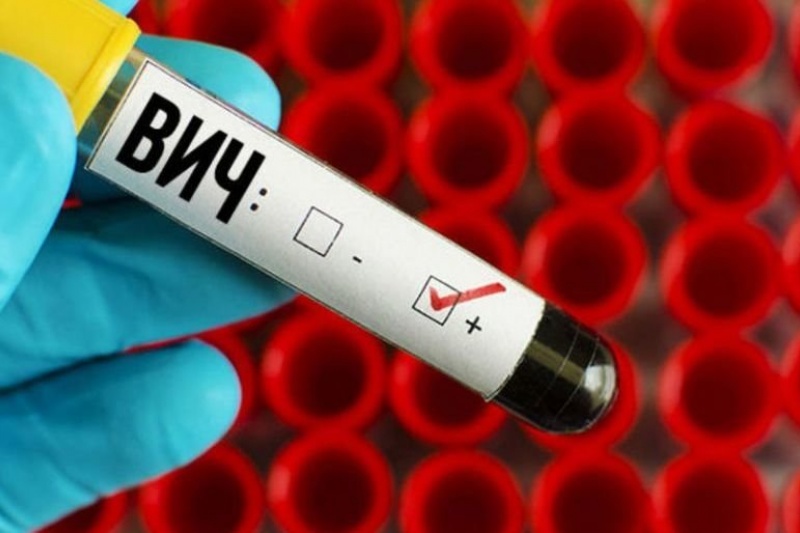 В Днепре увеличился показатель заболеваемости ВИЧ-инфекцией