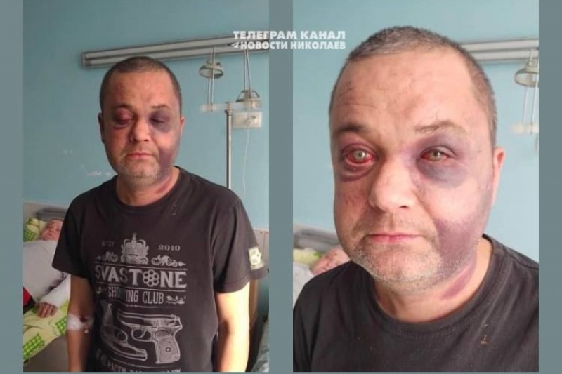 В Николаеве военкоматчики жестоко избили пожилого человека