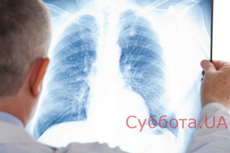 Массовая пневмония в Запорожской области: терапию переквалифицировали в пульмонологию
