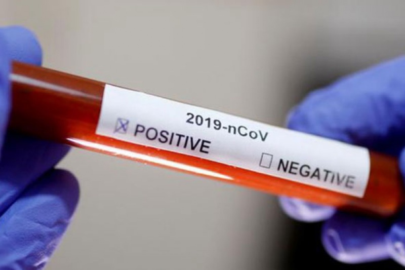 На Днепропетровщине уже 448 случаев коронавируса, обнаружили 13 новых случаев COVID-заболевания